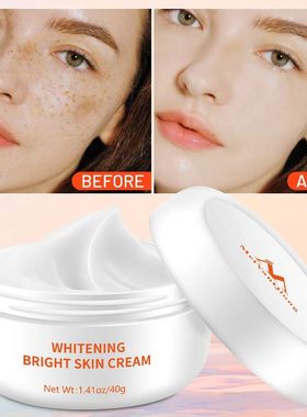 Moisturizer Face Cream Acne atment Remove Dark Spots Whiteni