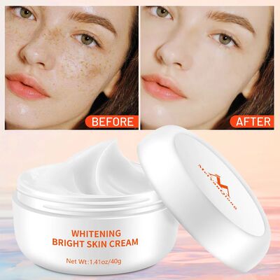 Moisturizer Face Cream Acne atment Remove Dark Spots Whiteni