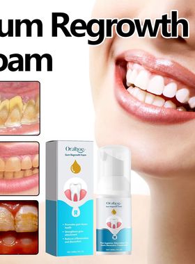 Gomas mousse creme dental clareamento dos dentes espuma remo