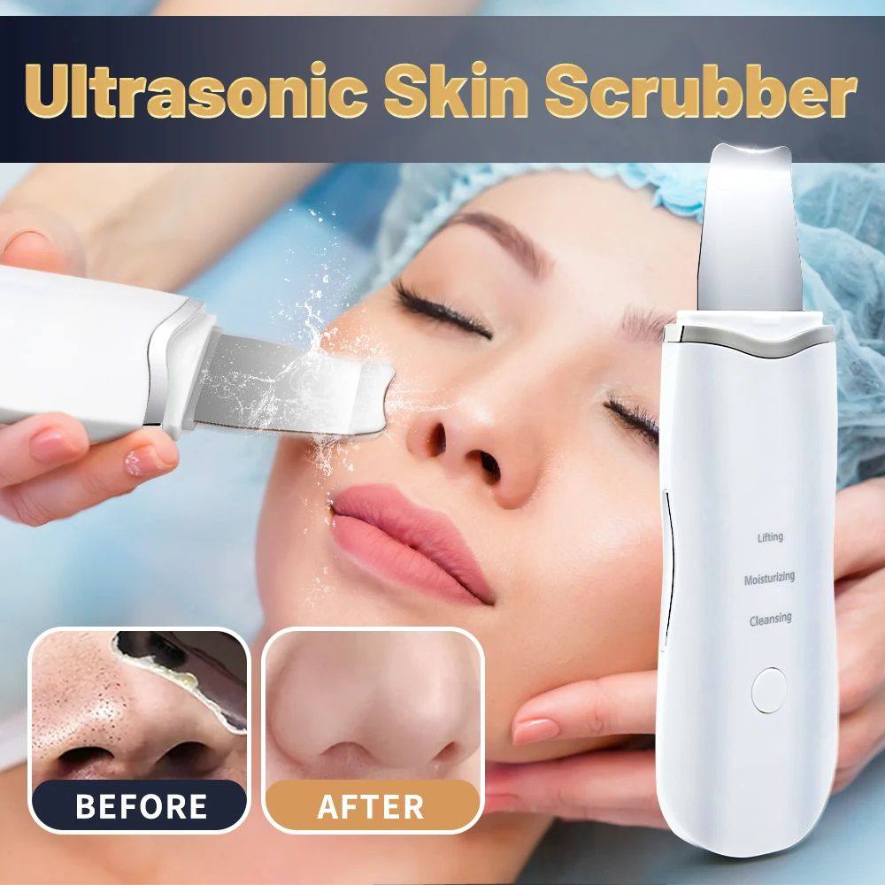 Ultrasonic Skin Scrubber Ance Pore Cleaner Peeling Blackhead
