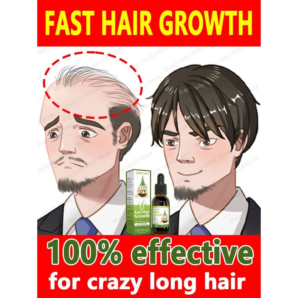 Essência de crescimento capilar, repara 100% a calvície e