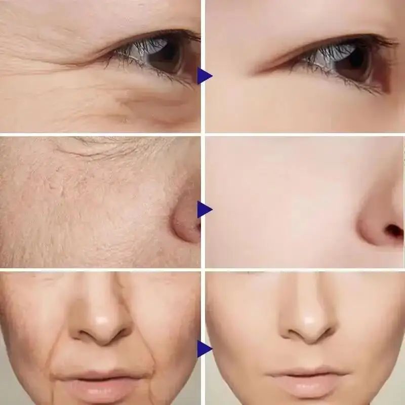 Vitamina C Facial Lifting Serum Set, Colágeno, Patches anti