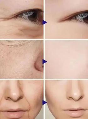 Vitamina C Facial Lifting Serum Set, Colágeno, Patches anti