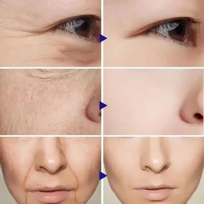 Vitamina C Facial Lifting Serum Set, Colágeno, Patches anti