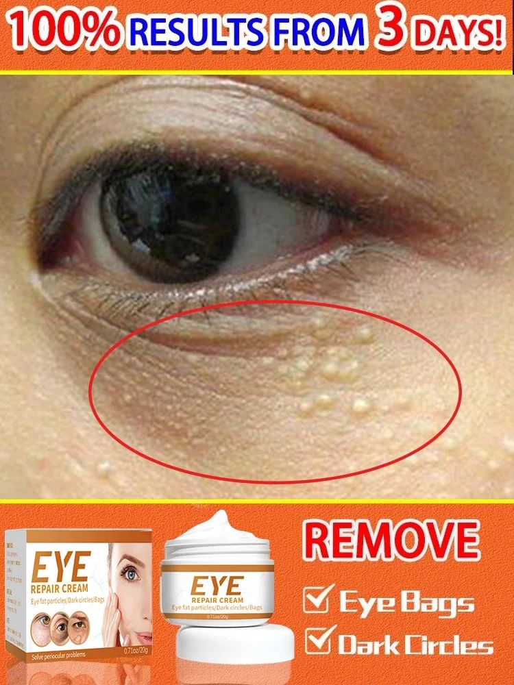Anti-rugas creme para os olhos, remover sacos, incha?o, cír