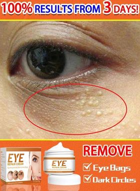 Anti-rugas creme para os olhos, remover sacos, incha?o, cír