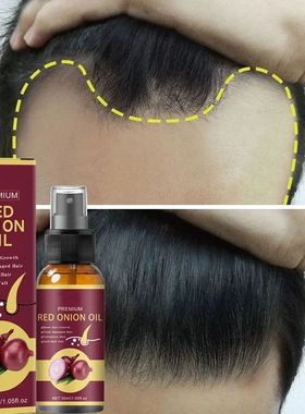 Poderoso Spray de soro para crescimento capilar Tratamento a