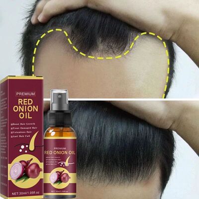 Poderoso Spray de soro para crescimento capilar Tratamento a