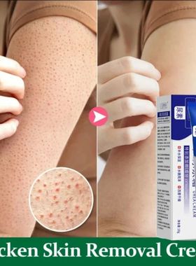 Creme para Repara??o Da Pele, Cura Queratose Pilaris, Folíc