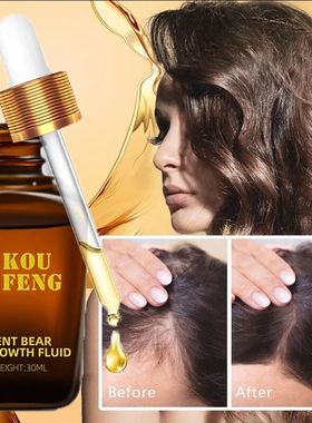 Koufeng crescimento do cabelo óleo essencial natural anti p