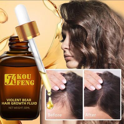 Koufeng crescimento do cabelo óleo essencial natural anti p