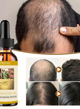 50ml barba crescimento óleo anti alopecia cabelo rebrota ó