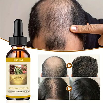 50ml barba crescimento óleo anti alopecia cabelo rebrota ó