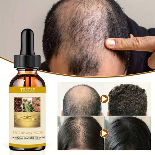 50ml barba crescimento óleo anti alopecia cabelo rebrota ó