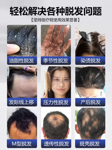 Shangguan Miao Шампунь для сильных и развитых волос с экстрактом растений, укрепляющий волосы для мужчин и женщин, контроль жирности и пушистость 8