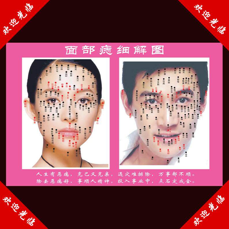 容痣图片面部穴位图n脸部男女面痣图画络美点院装饰经门贴字广告