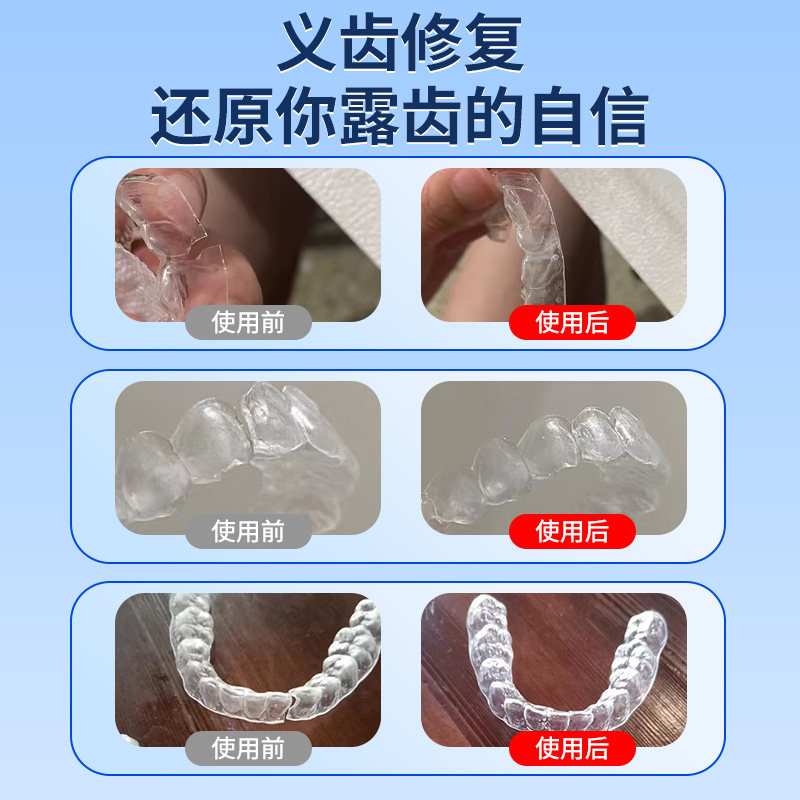 食品级粘假牙保持器断裂专用胶水烤瓷牙齿钢牙套牙冠强力透明修复快干