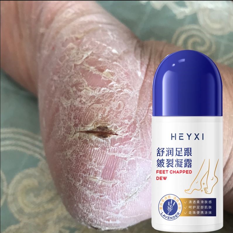 2瓶装【屈臣氏推荐 一夜嫩滑脚后跟】有效修护防干裂手脚可用按摩