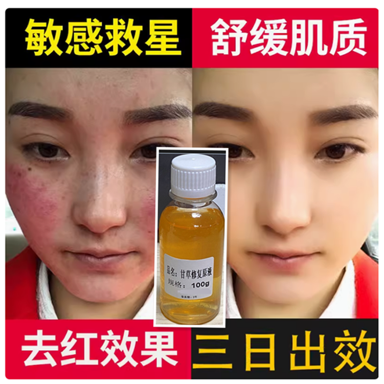 正品甘草精华原液 退红止痒激素脸祛红血丝修护屏障敏感肌100ml