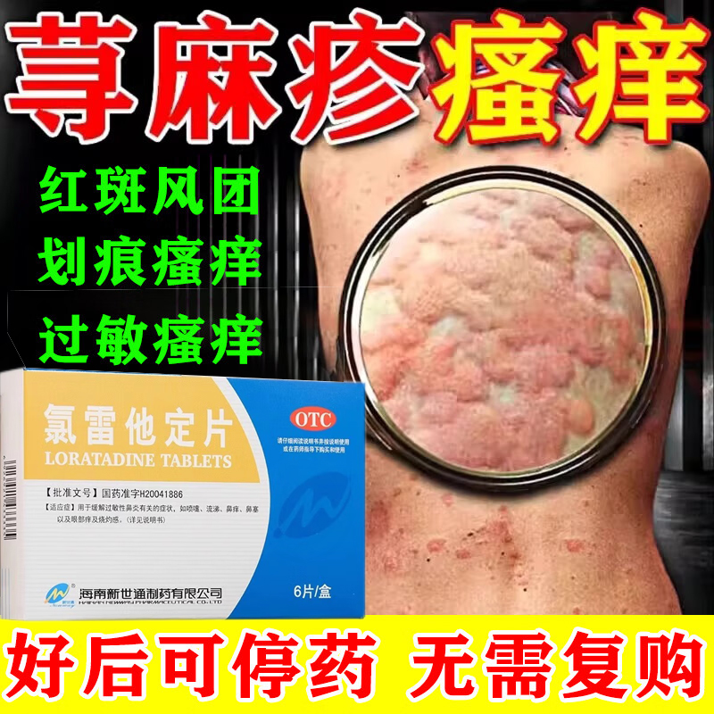 【新世通】氯雷他定片10mg*6片/盒20片仁开瑞坦良福护佑雪苏百为乐万通和官方旗舰店