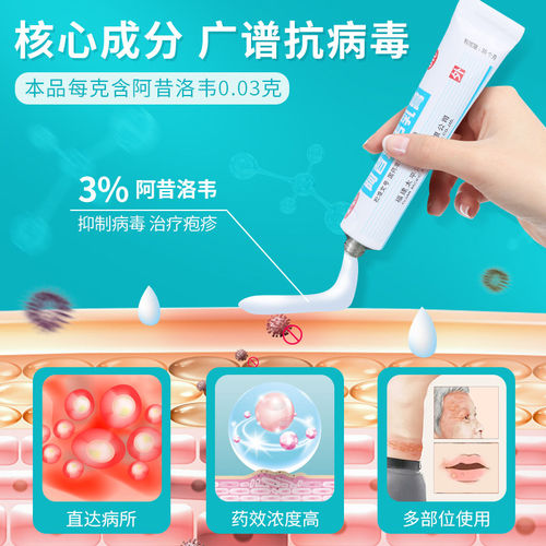 快比宁阿昔洛韦乳膏10g口唇腰疱疹抗病毒单纯带状疱疹感染软药膏