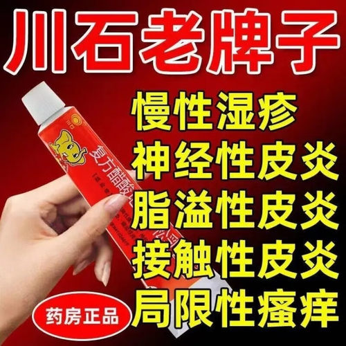 【川石】复方醋酸地塞米松乳膏10g7.5mg*10g*1支/盒20g30g999三九皮炎平官方旗舰店