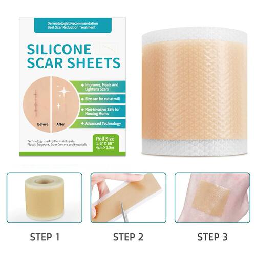 1 Roll = 4cm x 1.5m Silicone Scar Sheets Self-Adhesive Scar