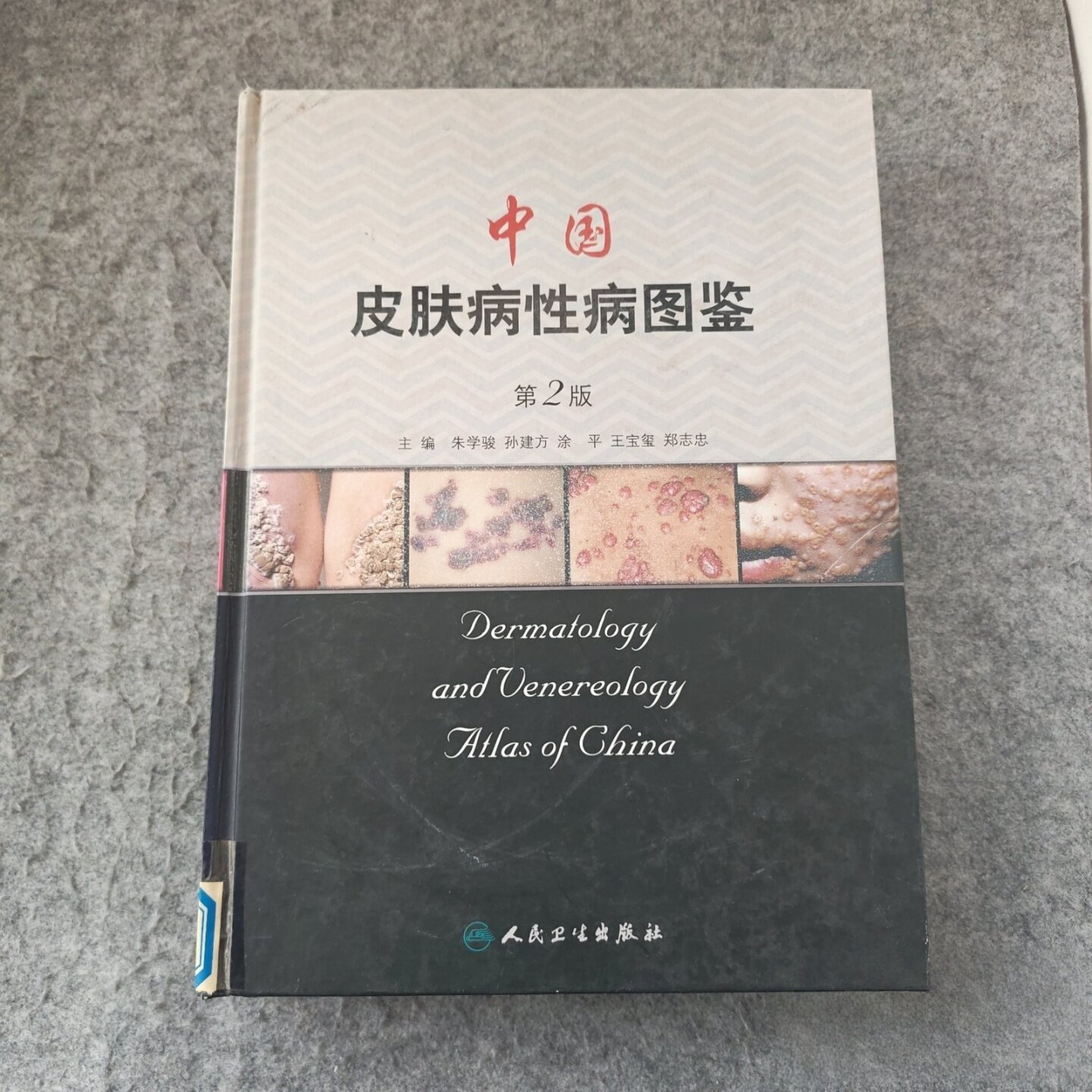 正版旧书 中国皮肤病性病图鉴 第2版 朱学骏 编 / 人民卫生出版社 / 2006-11 / 精装/