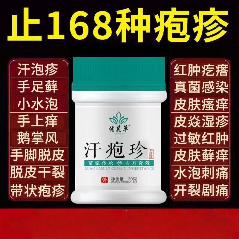 汗疱膏疹手痒脱皮手上药起小水泡保健理疗