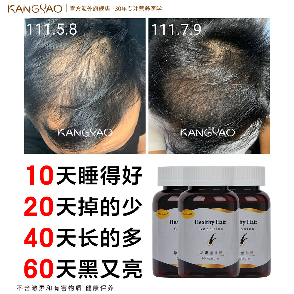 台湾康妍优丝丽头发胶囊白能黑加发不掉天然全食物营养素口服健发