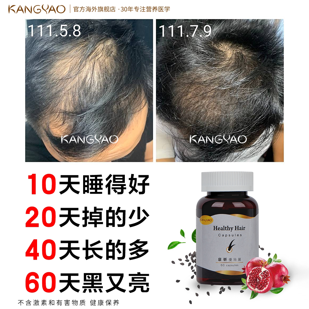 优丝丽发际线生发防脱长头发黑发