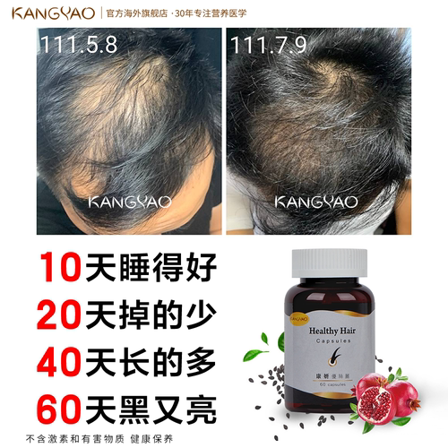 优丝丽发际线生发防脱长头发黑发