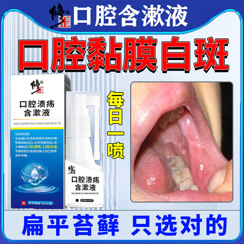 口腔溃疡专用口腔扁平苔藓喷剂口腔粘膜白斑修护舌头疼痛溃烂喷雾
