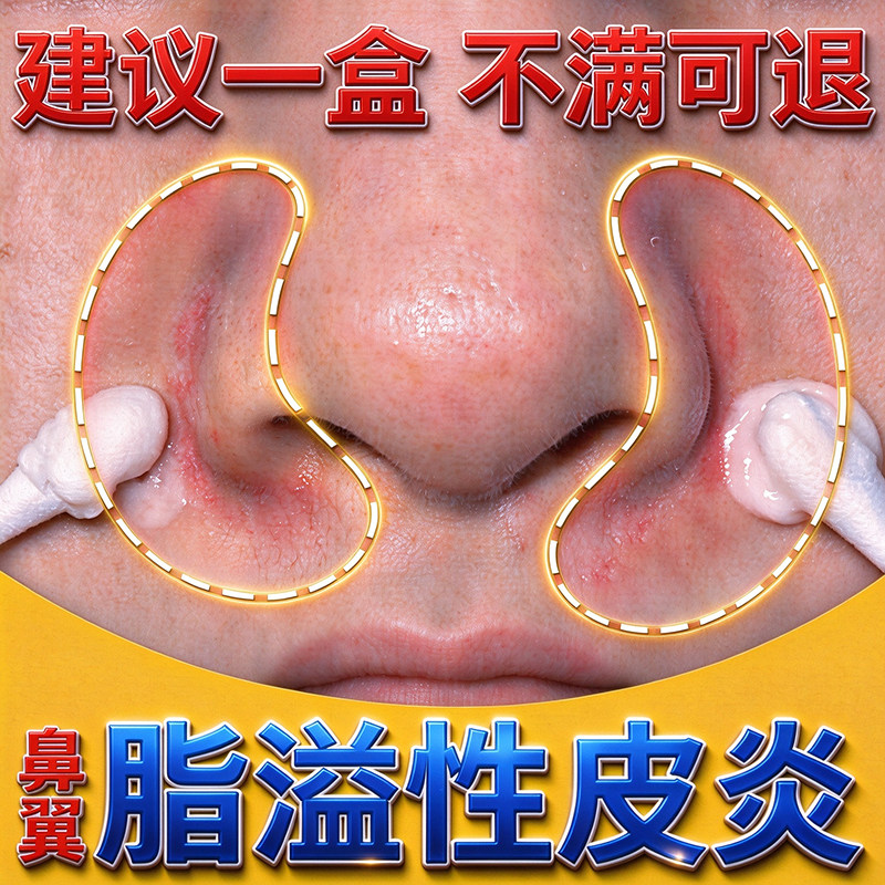 鼻翼两侧发红修复鼻子脱皮爱起皮红血丝瘙痒脂溢性皮炎凝胶修复