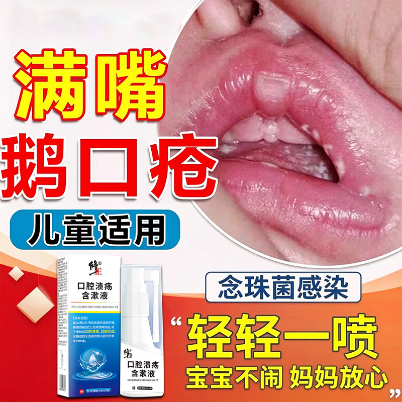 修正鹅口疮婴儿喷雾口腔溃疡专用儿童嘴巴溃烂起泡白斑含漱液