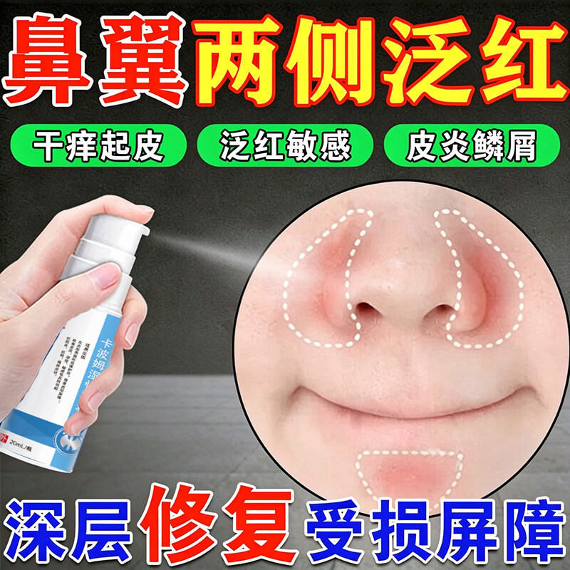 鼻翼两侧发红修复鼻子脱皮爱起皮红血丝瘙痒脂溢性皮炎凝胶修复