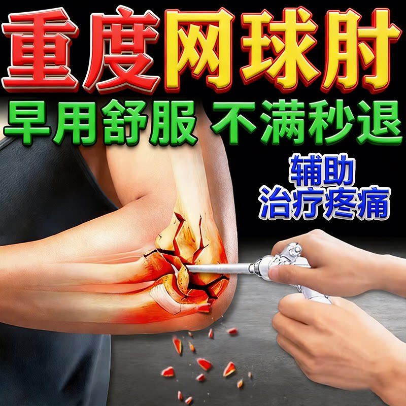 网球肘手臂疼痛无力专用膏药贴