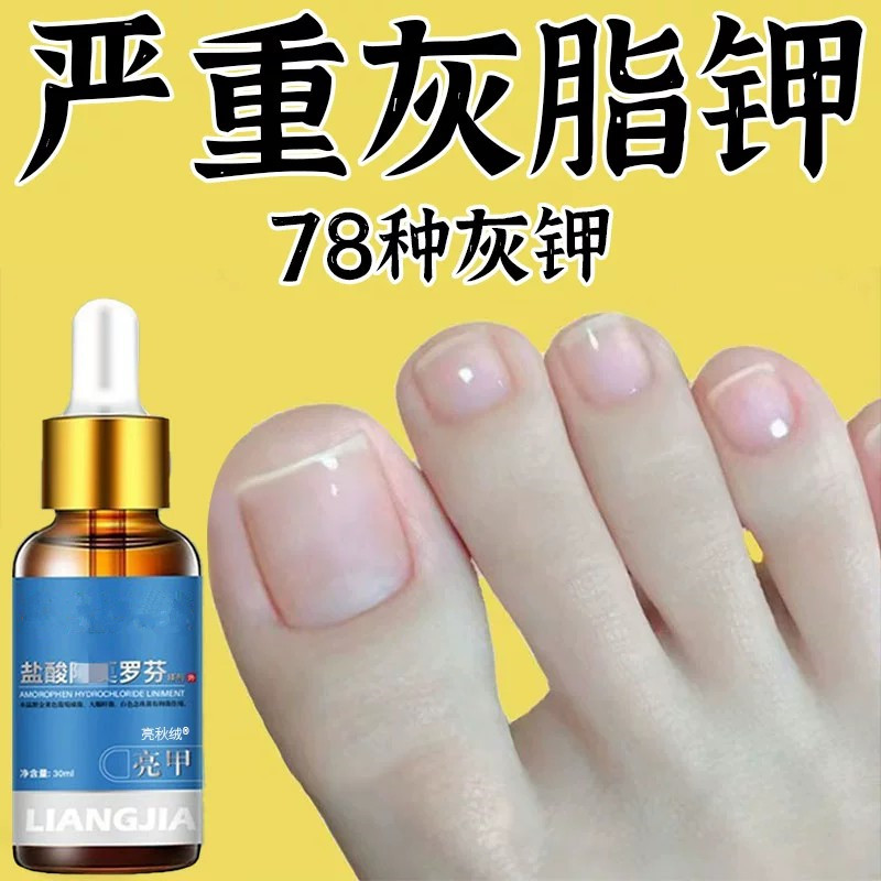 阿莫罗灰指甲芬搽剂修复液脱甲膏去除增厚药水正品官方旗舰店