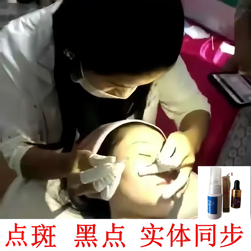 无痛点斑水 雀斑黑志笔色素无痕净擦专用提取药水护肤品供美容院