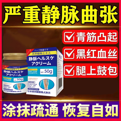 日本静脉曲张特效专用药膏平复腿部红血丝大小腿青筋凸凝胶舒缓膏