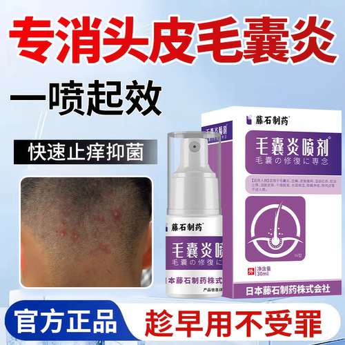 头皮毛囊炎特i效药头皮溢脂性毛囊炎治头皮红疙瘩专i用喷雾膏WT