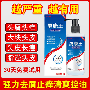 新康王止痒去屑洗发水露正品严重去头屑药头痒头皮屑藓控油除螨虫