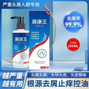 屑康王去屑止痒洗发水正品严重头屑头痒除螨头皮屑控油洗发露男女
