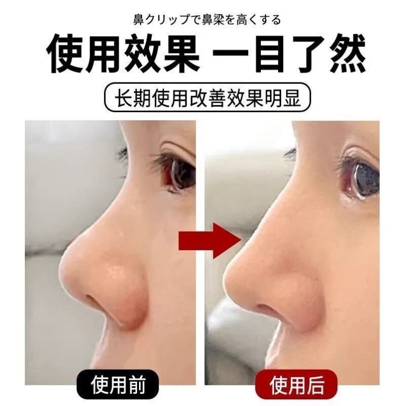 鼻夹提高鼻梁夹鼻翼缩小鼻子矫正器高鼻梁变挺增高器告别塌鼻梁