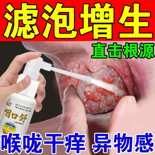 После пузырькового популицита спрей языком языка популярный фарингеальный лимфы с посторонними объектами для лечения хронического фарингита артефакт ларингита Япония