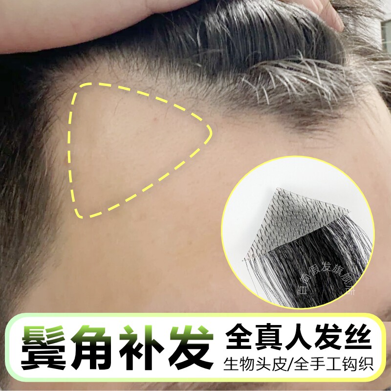 发际线贴男鬓角假发男士前额补发全真发丝隐形m型额角假发浏海片