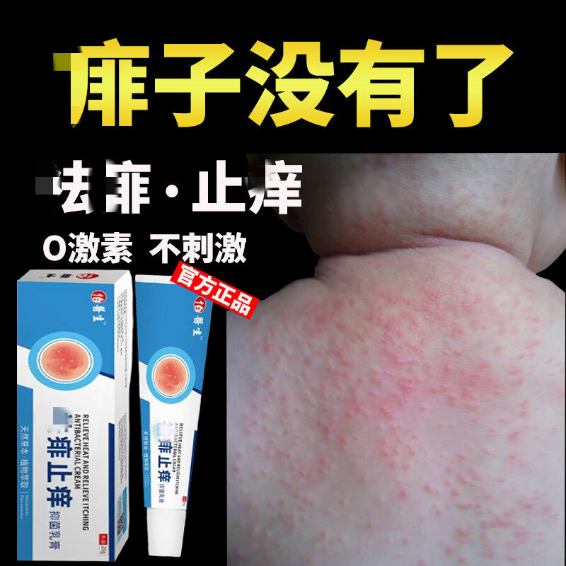 痱子膏去痱止痒治宝宝儿童婴儿小孩身上起红痱长热痱药祛痱神器水