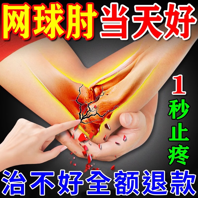 网球肘克星专用药进口治