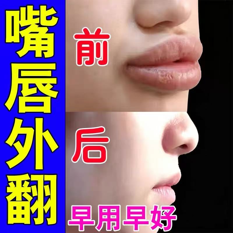 瘦唇膏嘴唇变薄变小外翻