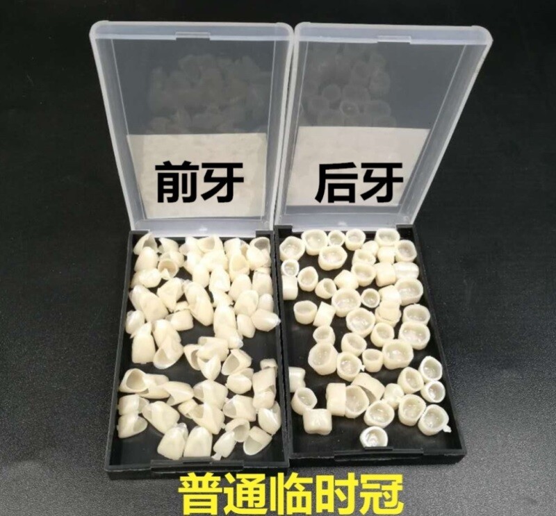 单个牙套一颗牙假牙套牙仿真牙齿遮丑门牙临时牙套缺牙吃饭防塞